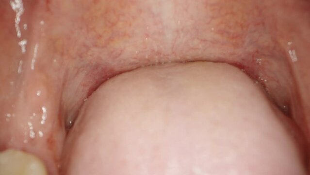 Camera probe inside the mouth, medical examination. Tongue close-up.