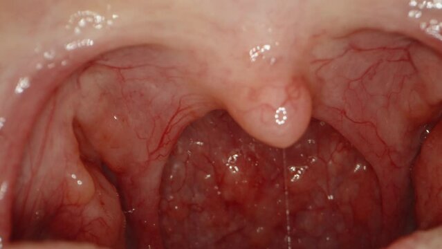 Examination of the zones inside the female mouth, slides over the tongue and comes out. Macro