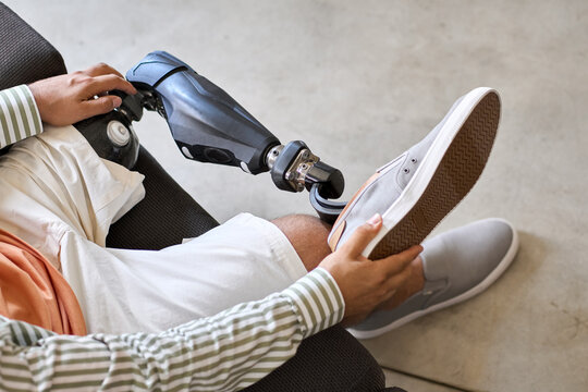 Man amputee with prosthetic leg disability on above knee transfemoral leg prosthesis wearing shoe sitting on sofa, close up. People with amputation disabilities everyday life concept.