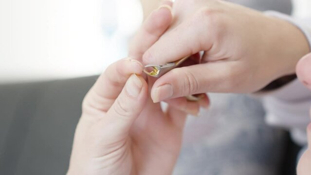 A woman bites off the skin from her finger with manicure tweezers, close-up.