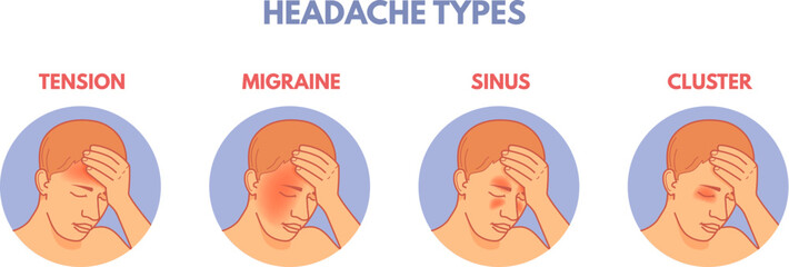 Headache types. Headaches areas infographic diagram medical poster, brain pain type in head sinus migraine tension or cluster, anatomy part of hospital patient vector illustration