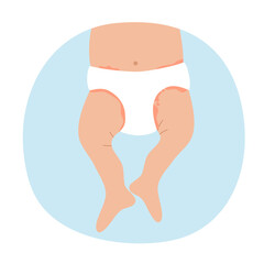 Baby diaper rash symptom in flat design.