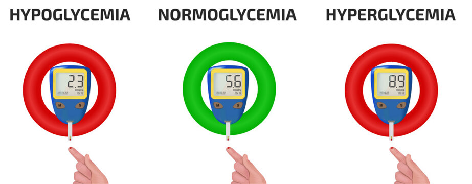 A concept for measuring mmol-l blood glucose levels. Low blood glucose, normal blood glucose, high blood sugar on the glucose meter display. Hyperglycemia, hypoglycemia, normoglycemia.