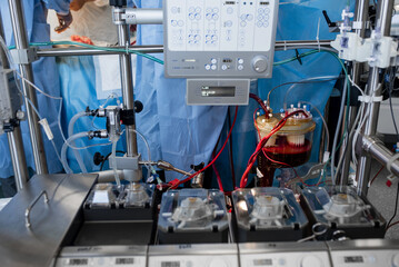 Heart lung machine for heart surgery in operating room. Apparatus circulation blood in operating...