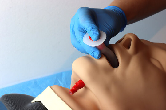 Oropharyngeal airway Beeing inserted by a health care professional wearing gloves