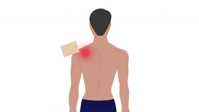 Animated video of a man with shoulder pain, and a medical patch to relieve back pain. A patch for muscle pain. A man uses a band-aid to relieve shoulder pain Generative AI