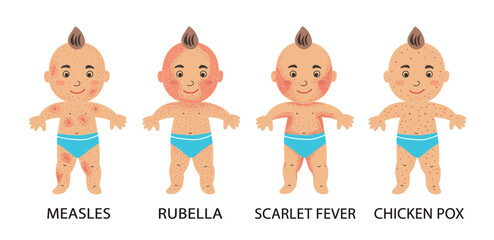 Infographics of childhood rash, measles, rubella, scarlet fever, varicella. Poster with a baby with chickenpox. Medical theme and infectious diseases of children. 
