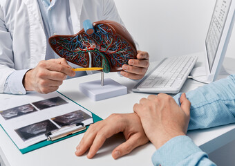 Human liver model on doctor's table, close-up. Treatment of hepatitis, cirrhosis and liver cancer - 598510897