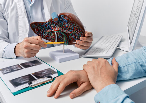 Human liver model on doctor's table, close-up. Treatment of hepatitis, cirrhosis and liver cancer