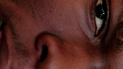 Vertical video. Skin problem. Facial care. Acne treatment. Closeup of man half face with clogged enlarged pores blackheads on cheek and nose. Generative AI