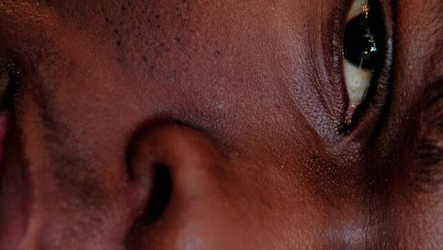 Vertical video. Skin problem. Facial care. Acne treatment. Closeup of man half face with clogged enlarged pores blackheads on cheek and nose. Generative AI