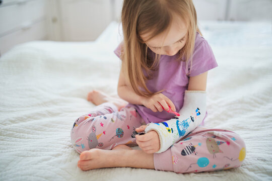 Adorable preschooler girl with a broken arm at home on the bed draws with felt-tip pens on an orthopedic cast