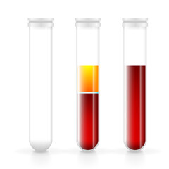 Blood in glass flasks, transfusion and testing. Laboratory and vacutainer collection tube. Medical flasks icons with blood and plasma. Vector illustration. Generative AI