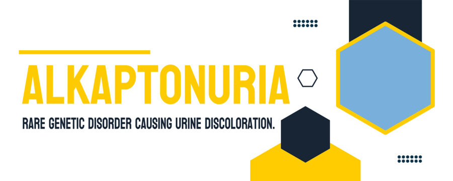 Alkaptonuria - a rare metabolic disorder