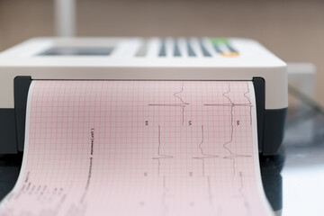 a cardiologist makes an ECG cardiogram for a patient prints an analysis of the patient's pulse rate...