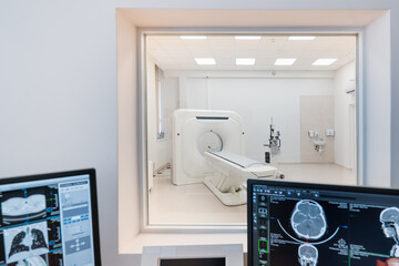 Computer tomography equipment in the clinic a screen with a tomographic image in the medical research room