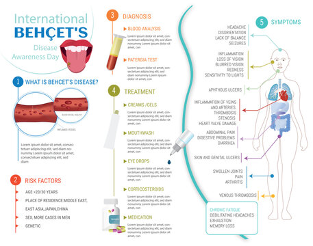 Infographic of Beh&ccedil;et's disease, symptoms, causes, risk factors and treatment on white background.