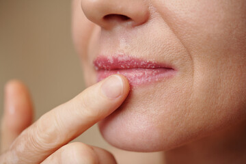 Closeup image of woman scrubbing lips to get rid of dead skin cells