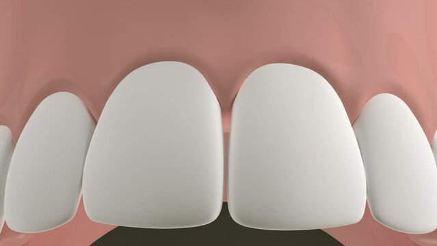 Demonstration of bacterial elimination in the oral cavity with toothpaste or mouthwash 3d