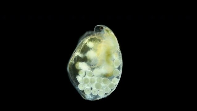 Water flea Daphnia Simocephalus vetulus under a microscope, class Branchiopoda, famile Daphniidae. Dwells in fresh water. Female with eggs.