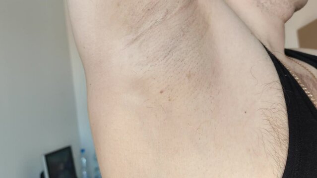 Man shows a depilated right armpit after depilation with small hair remnants