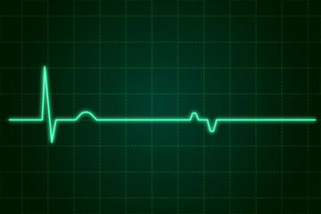 EKG monitor in intra aortic balloon pump machine in icu on blur background, Brain waves in electroencephalogram, heart rate wave