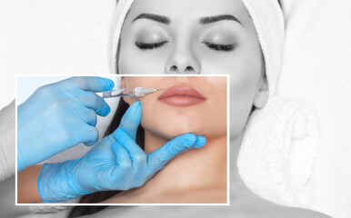 The doctor cosmetologist makes Lip augmentation procedure of a beautiful woman in a beauty...