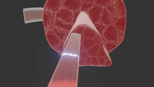 Muscle Cell and Motoneuron