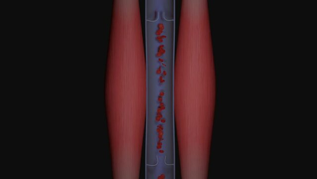 Improving Blood Circulation with the Muscle Pump