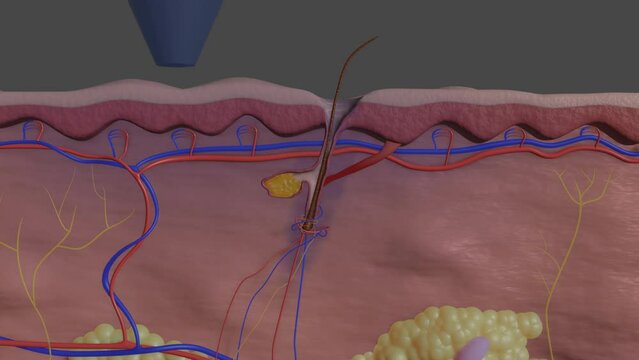 Treating Hair Loss