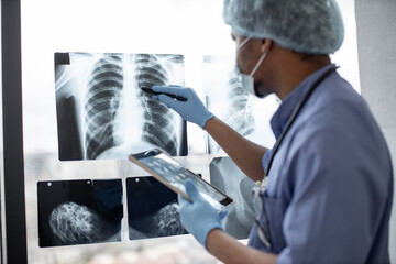 Focus on chest X-ray examination studied by multiracial healthcare practitioner in protective garment using tablet with stylus pen. Male radiologist identifying mass in left lung using technologies. - obrazy, fototapety, plakaty