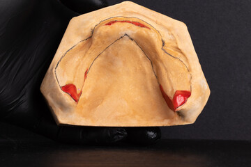 Lower edentulous arch model with wax relief.