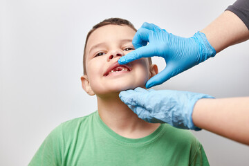 Examination of the oral cavity of a boy with missing milk teeth. Loss of milk teeth in children.