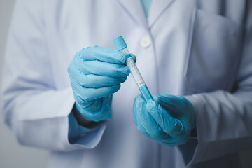 Lab assistant, a medical scientist, a chemistry researcher holds a glass tube through the blood sample, does a chemical experiment and examines a patient's blood sample. Medicine and research concept.