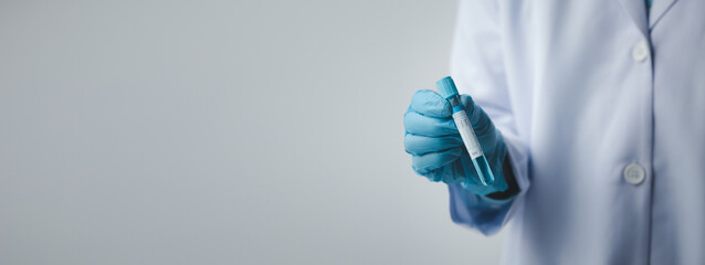 Lab assistant, a medical scientist, a chemistry researcher holds a glass tube through the blood sample, does a chemical experiment and examines a patient's blood sample. Medicine and research concept.