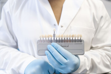 Dental technician hold palette of shades of teeth scale. Close up of shade guide to check veneer of tooth crown in a dental laboratory.