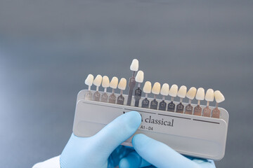 Dental technician hold palette of shades of teeth scale. Close up of shade guide to check veneer of...