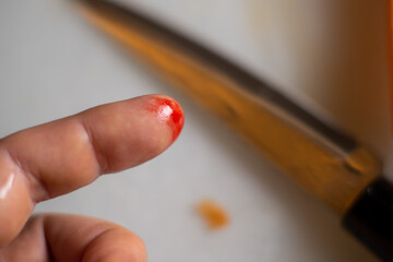 finger cut in the kitchen. Male finger with a wound and blood on a blurred background of a kitchen...