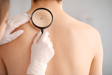 Dermatologist examining mole on young man's back with magnifier in clinic, closeup