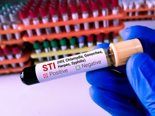 Biochemist or Lab Technologist holds Blood sample for STI or Sexually Transmitted Infection Test...