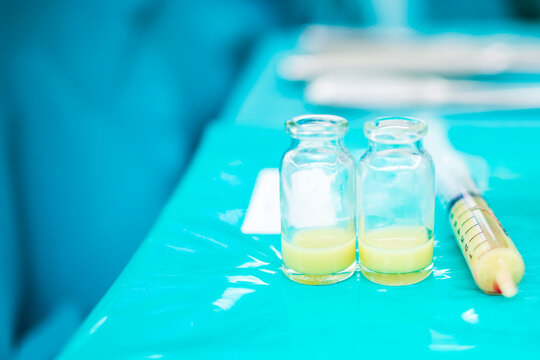 Pus specimen in medical bottles and syringe in orthopedic operating room.Yellow turbid pus fluid on green table with blur background.Arthrocentesis from septic knee or shoulder joint infection.