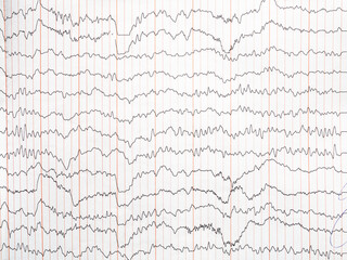 encephalogram on paper - trace of electrical activity of human brain