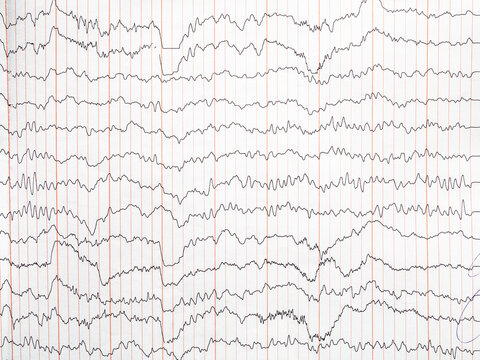 encephalogram on paper - trace of electrical activity of human brain