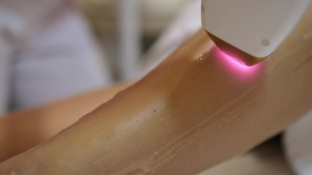 Close-up of hair removal cosmetology procedure. Aesthetic cosmetology. Laser epilation and cosmetology. A woman doing a procedure to remove unwanted hair on her legs using a laser in a beauty salon