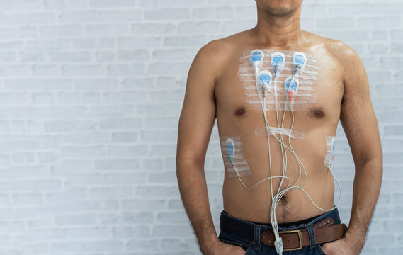 Man wearing 24 hrs electrocardiogram monitor device on his chest, Electrodes rhythm Holter monitoring and blood pressure monitor system on the chest of a man. Health care heart disease concept.