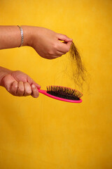 Woman's hands take a hairbrush with many fallen hairs after brushing for alopesia, anemia or...