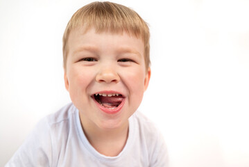 Cute child boy shows his baby white healthy teeth and open mouth close-up. The concept of oral hygiene, healthy teeth