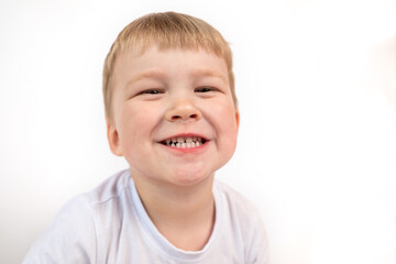 Child boy shows his baby white healthy teeth close-up. The concept of oral hygiene, healthy teeth