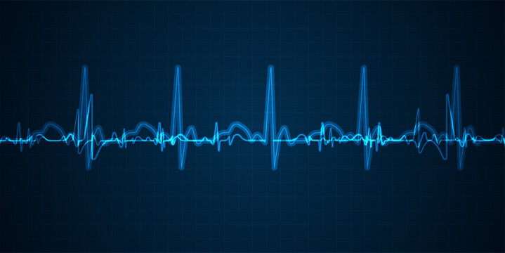Emergency ekg monitoring. Blue glowing neon heart pulse. Heart beat. Electrocardiogram