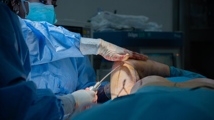 arm lift surgery. Doctor doing liposuction for fat on woman's arm in arm lift surgery 